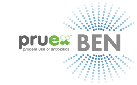 1.1 Pruex Ben base unit with up to four spray nozzles